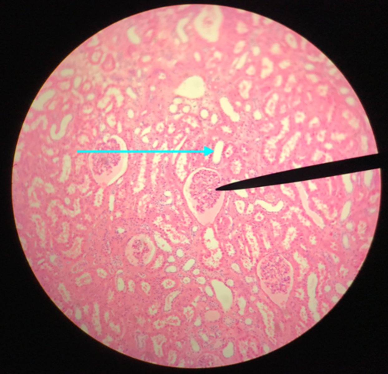 <p>What structure of the kidney is the blue arrow pointing at?</p>