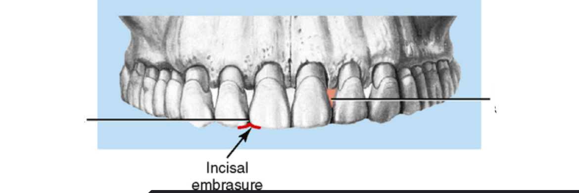 <p>Triangular space around contact area </p>