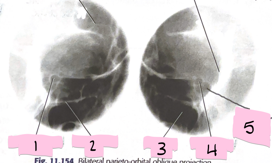 <p>What is 2 pointing to?</p>