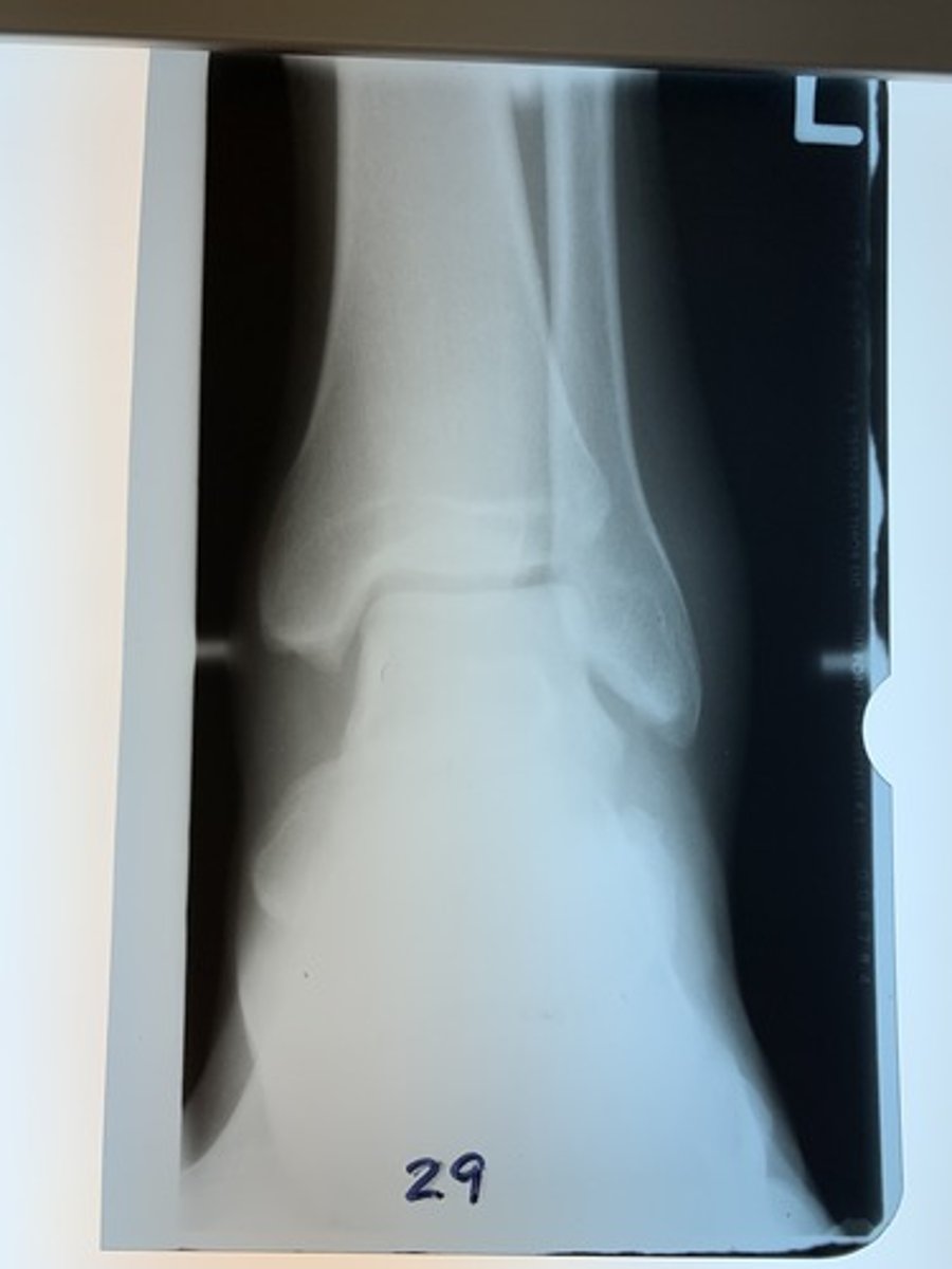 <p>Underexposed</p><p>2 multiple choice options</p>