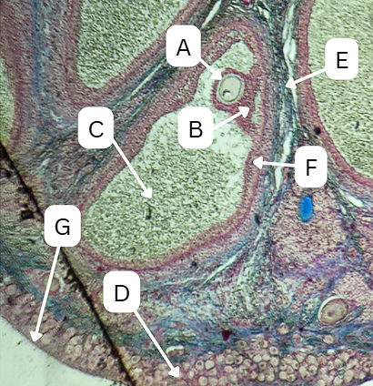 <p>What is the thin, fibrous connective tissue capsule located directly beneath structure D?</p>
