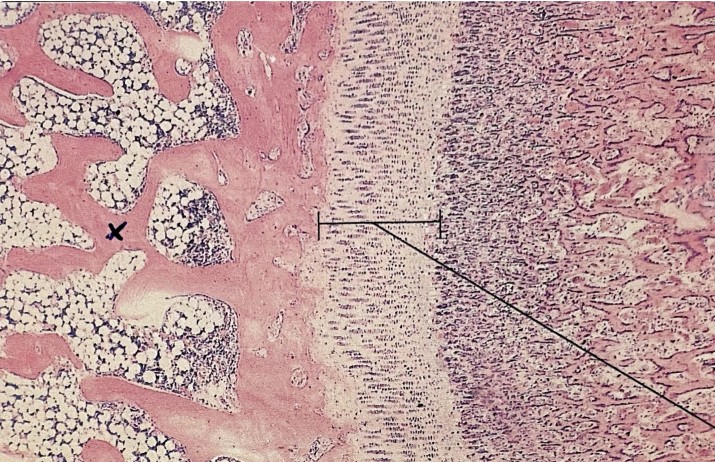 <p>Which type of bone has:</p><ul><li><p>Inner bone, web like - trabeculae, bone marrow</p></li></ul><p></p>