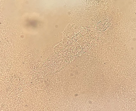 term image