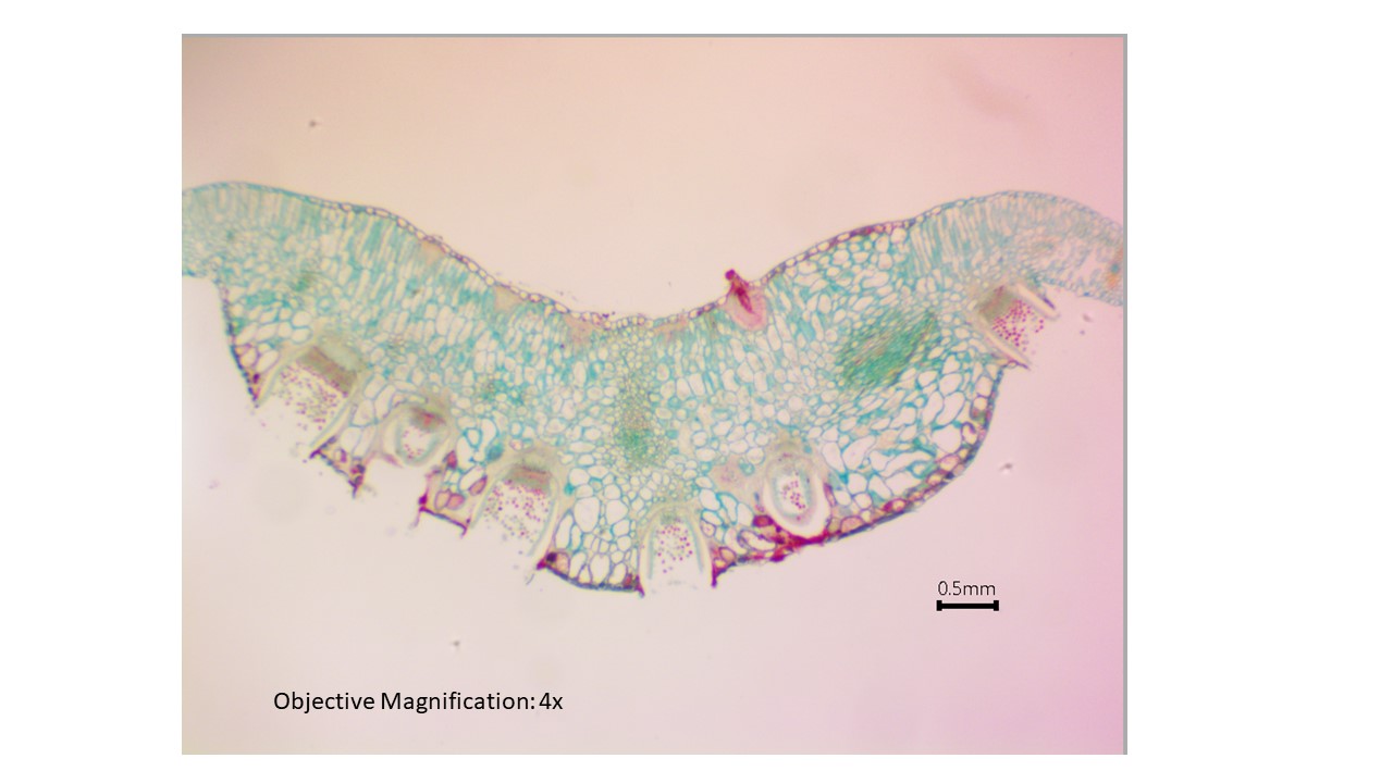 <p>Basidiomycota</p>