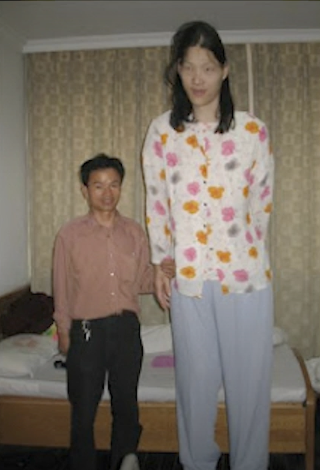 <p>It’s a dominant trait, b/c even if one copy of the GHRH receptor gene (e.g. in mom’s DNA or dad’s DNA) is mutated this would mean the somatotropic cells would self-activate and produce GH homrone starting in childhood well before the long bones close. And therefore this would cause <strong><u>gigantism</u></strong>.</p>