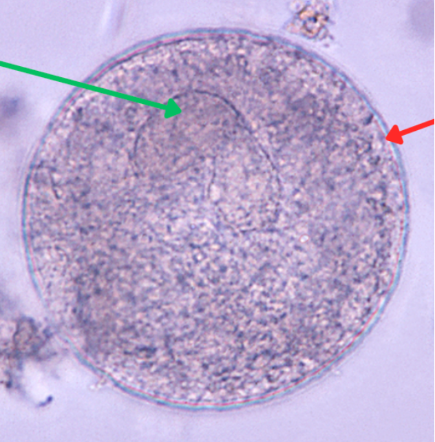 <p>What is at green arrow? (1)<br>What is at red arrow? (2)</p>