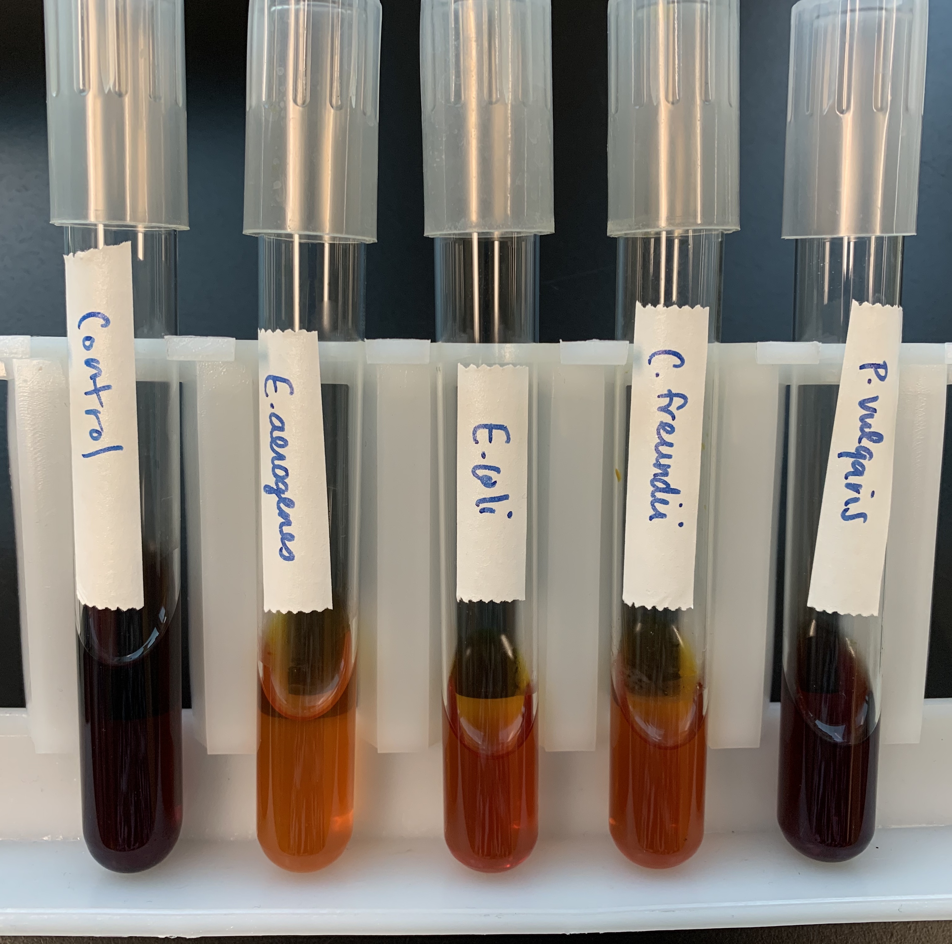 <p>#21 Utilization of Unusual Nitrogen (Ammonium Phosphate)</p>