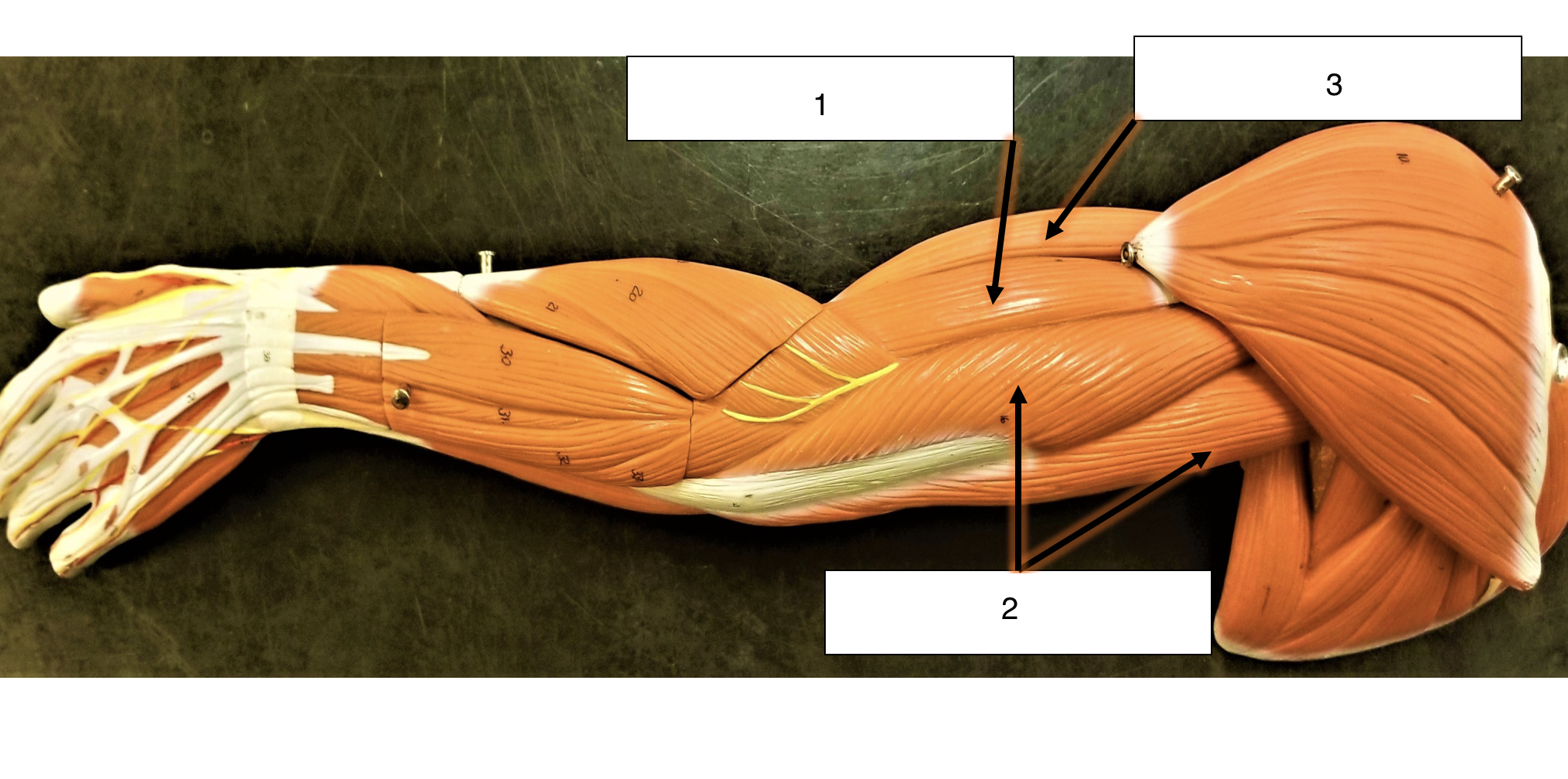 <p>name the muscle (2)</p>