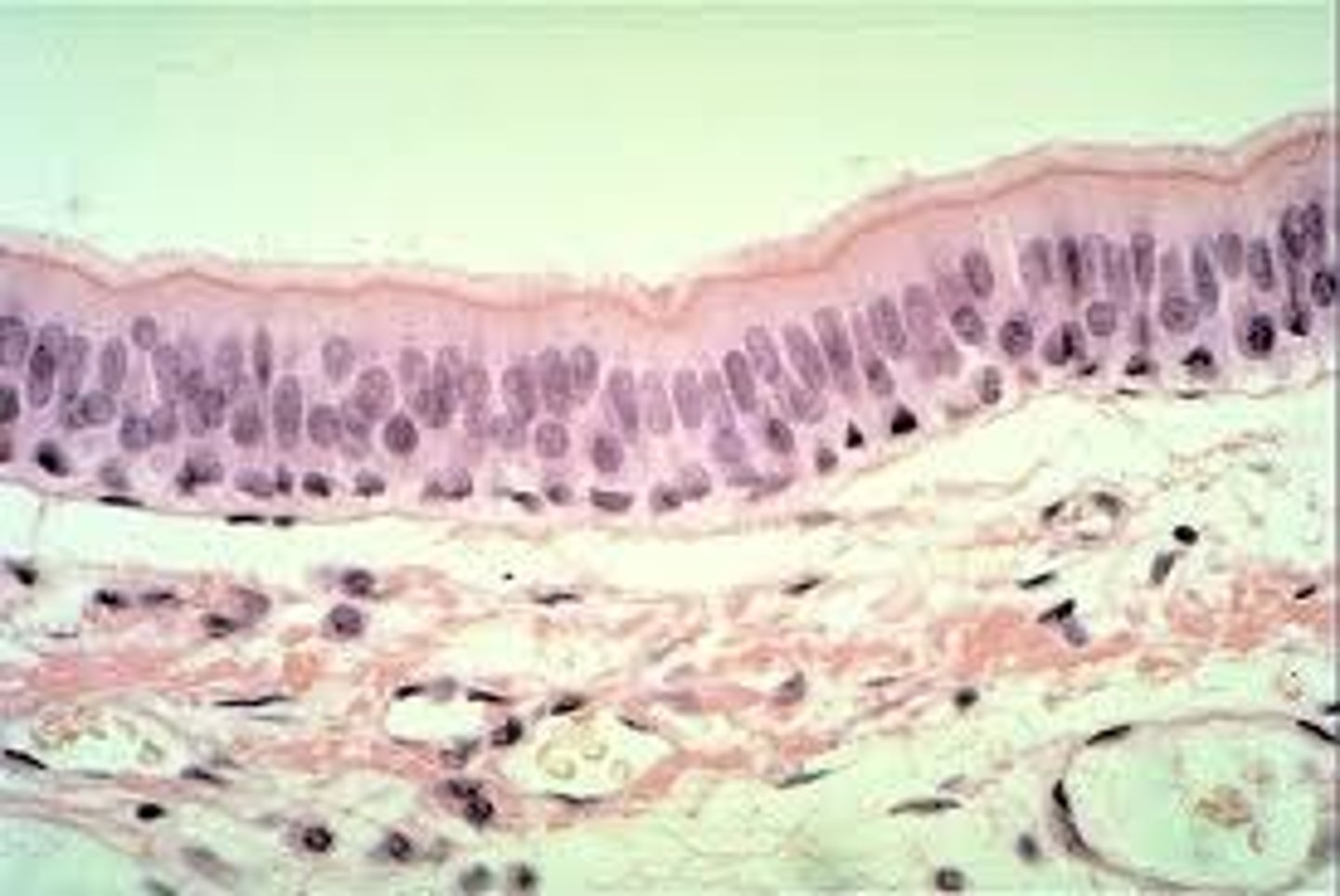 <p>example: trachea<br>function: produces and moves mucous<br><br>two or more layers thick and involved in protection; tall column-like ciliated</p>