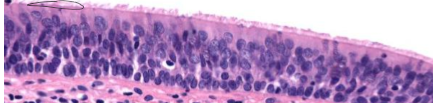 <p>What is the type of epithelium present in the image?</p>
