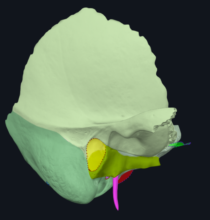 <p>What is highlighted in pink</p>