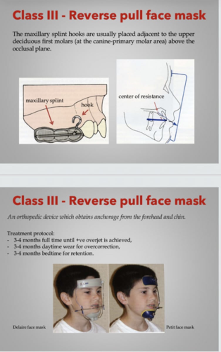 <p>class III</p><p>removable</p><p>Functional</p>