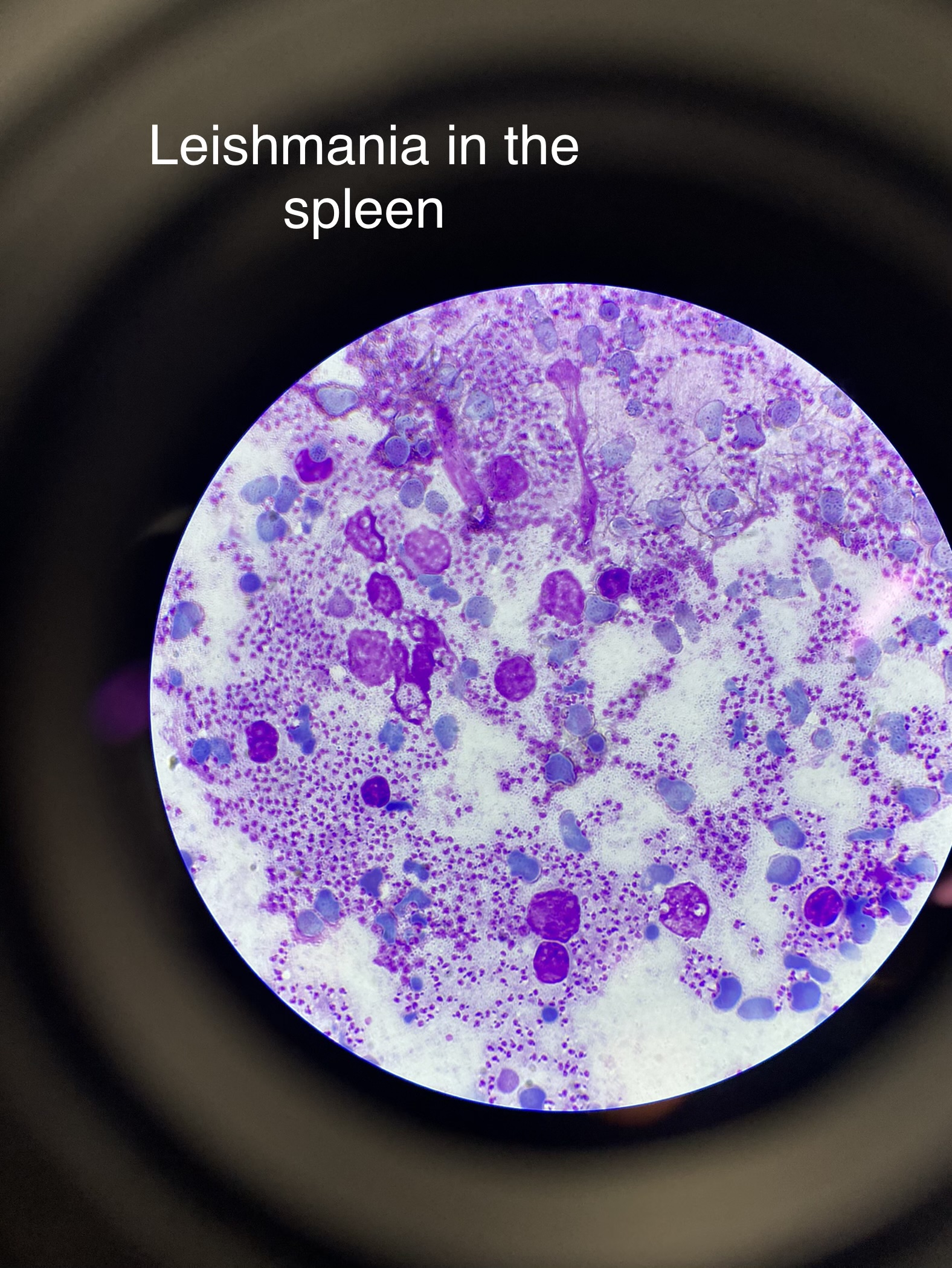 <ul><li><p>causes leishmaniasis </p></li><li><p>found in South America and North Africa, Asia</p></li><li><p>sand fly is the vector</p></li></ul>