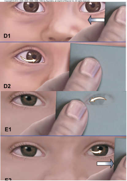 <p>Determines presence of eye deviation </p>