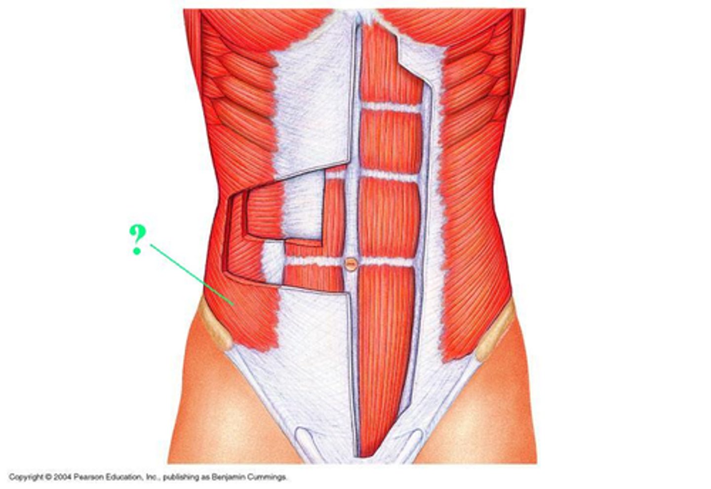 <p>Idenitfy the indicated muscle</p>