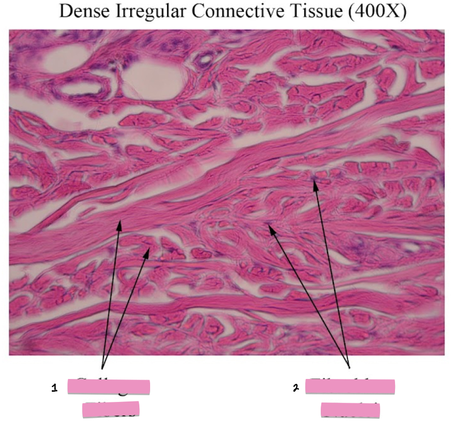 <p>(2) Dense irregular connective tissue cellular characteristics</p>