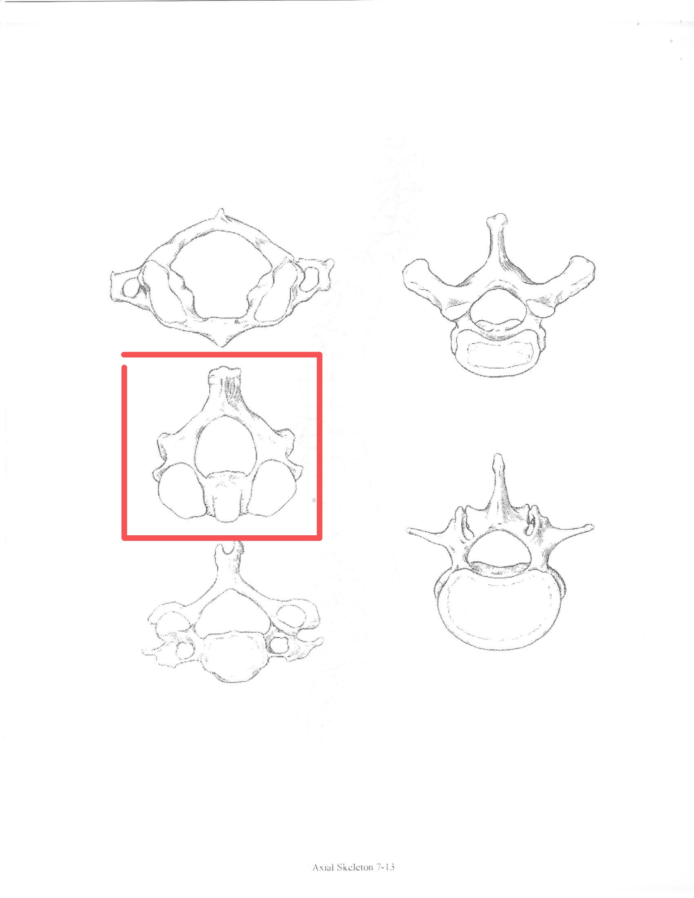 <p>ID bone</p>