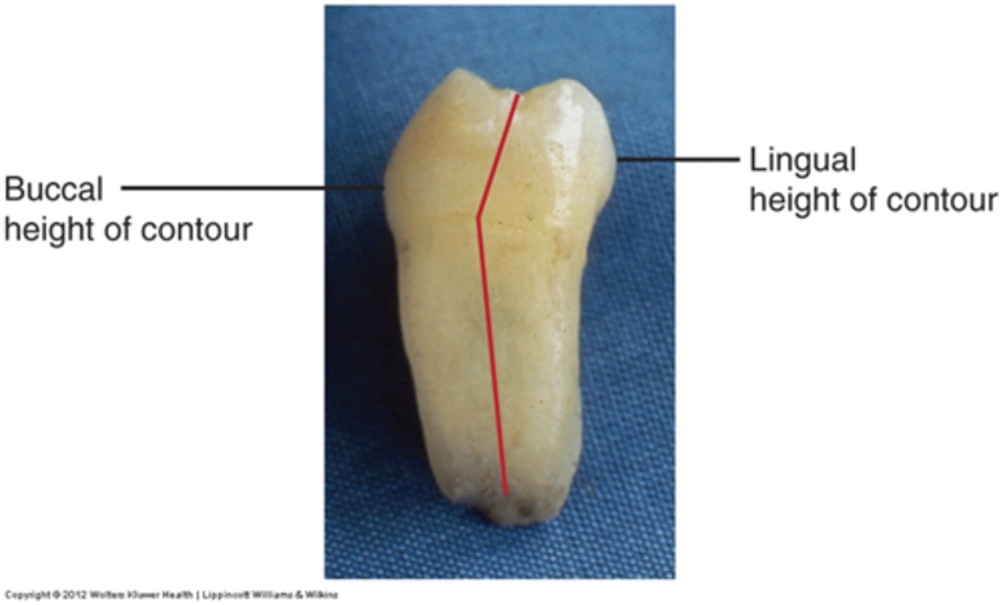 <p>middle third (true for all posterior teeth)</p>