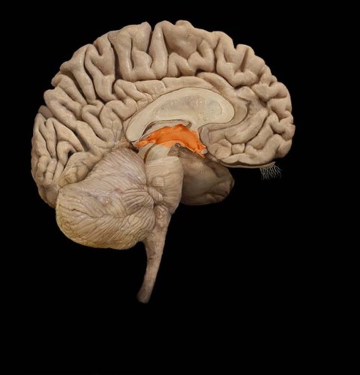 <p>Associated with basal ganglia, involved in motor control</p>