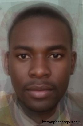 <p>Identify this Phenotype</p>