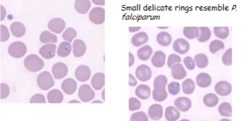 <p>What is the genus, species, and stage of this parasite?</p>