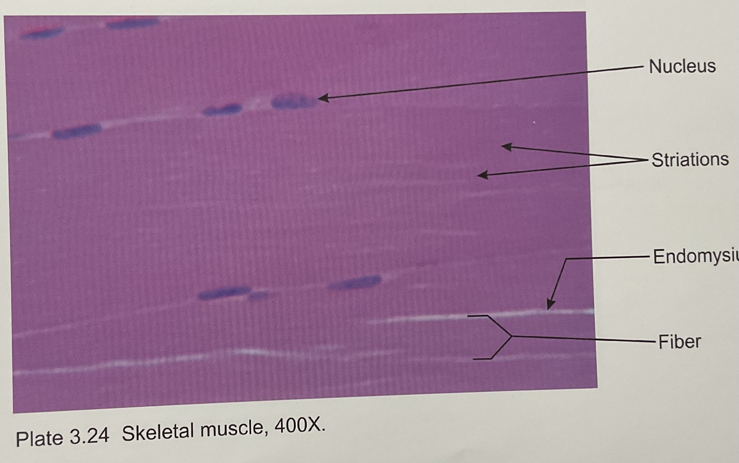<p>Skeletal tissue</p>
