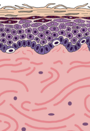 <p>covers all body regions excepts the palms, palmar surfaces of digits, and soles</p><ul><li><p>hairy skin</p></li></ul><p></p>