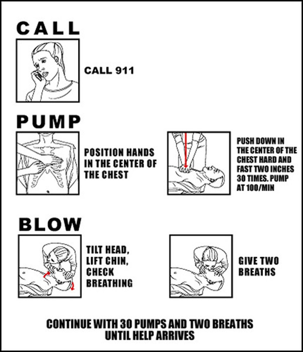 <p>hand position: 2 hands in center of chest</p><p>compression depth: 1 1/2 - 2 inches</p><p>cycle: 30 compressions, 2 breaths</p><p>rate: 30 compressions in 18 seconds or 100 per minute</p>