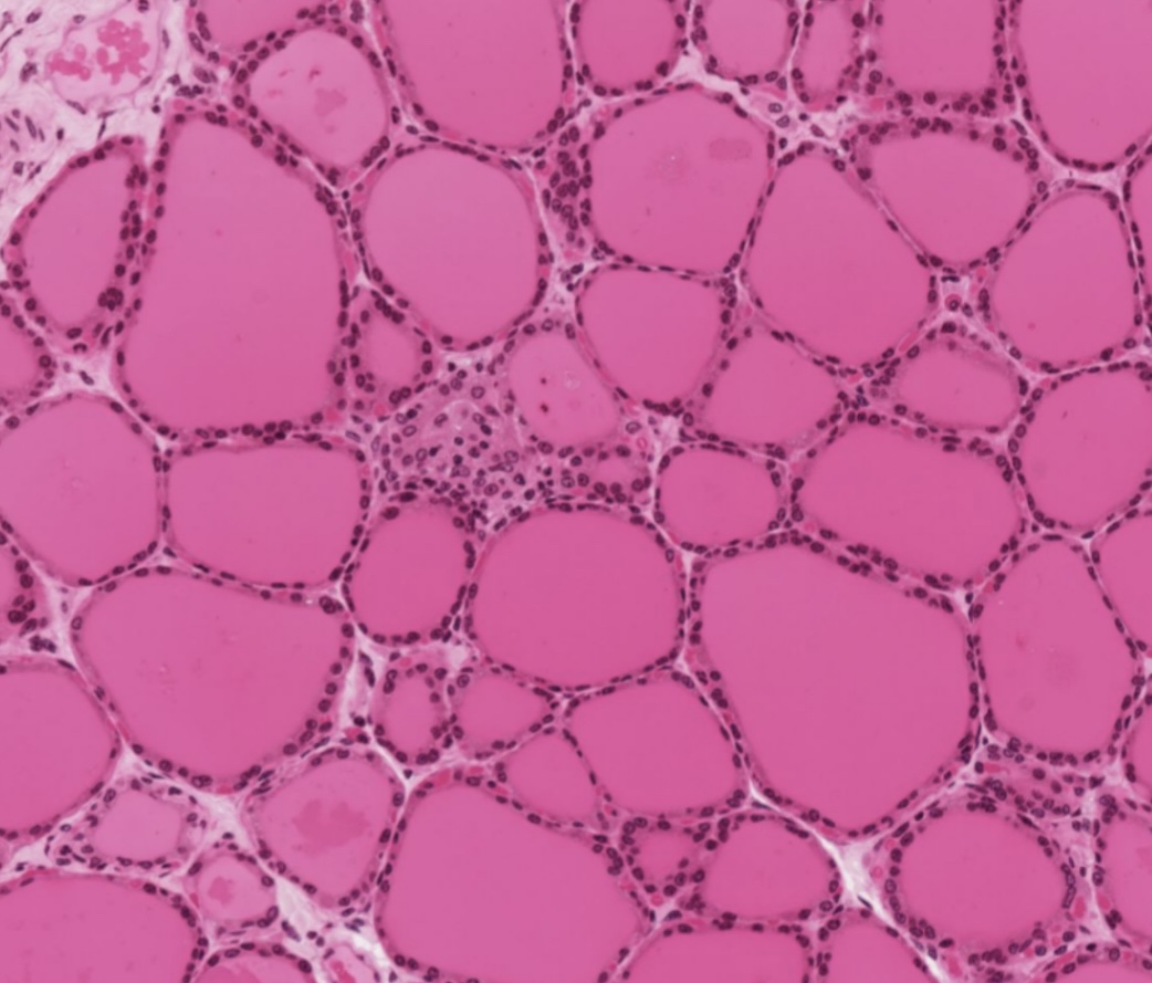 <p>Colloid</p>