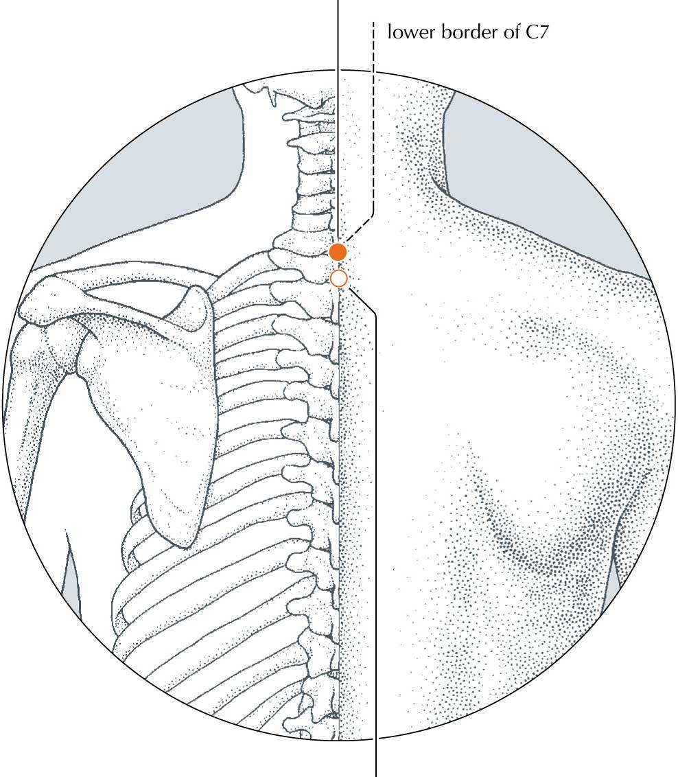 <p>DU-14</p>