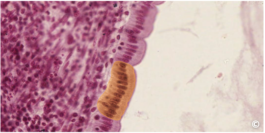 <p>identify type of epithelium</p>