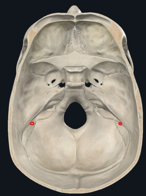 <ul><li><p>Fosa craneal posterior</p></li></ul><p></p>