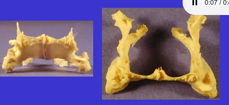 <p>Palatine bone (posterior part of hard palate, connecting it to soft palate)</p>