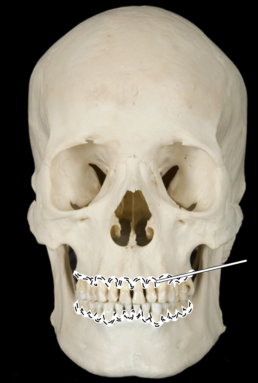 term image
