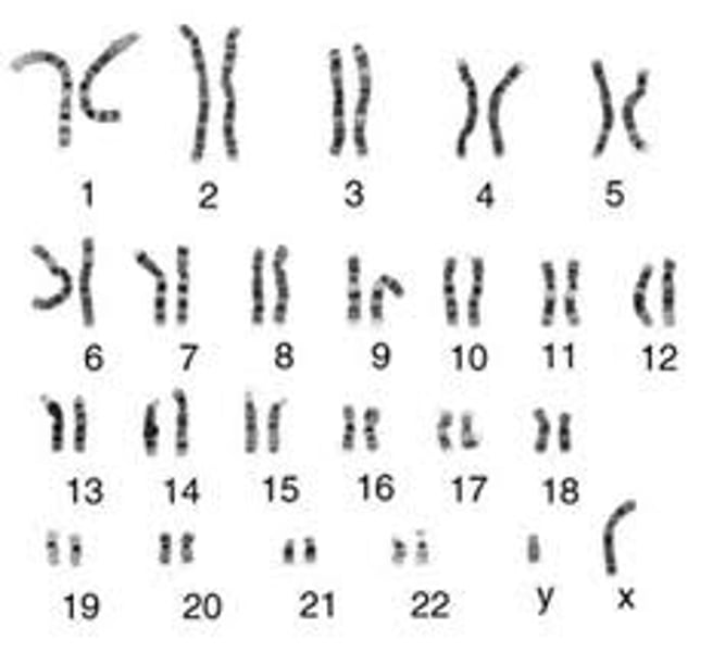 <p>an individual's complete set of chromosomes.</p>