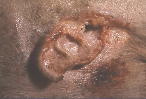 <p>Most common: house hold pets </p>