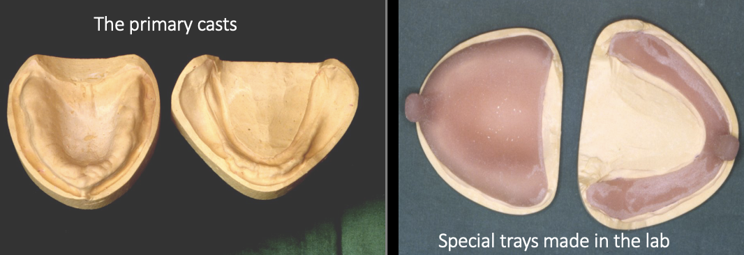 <ul><li><p>to record the patient’s anatomy to allow the construction of special trays </p></li></ul><p></p>