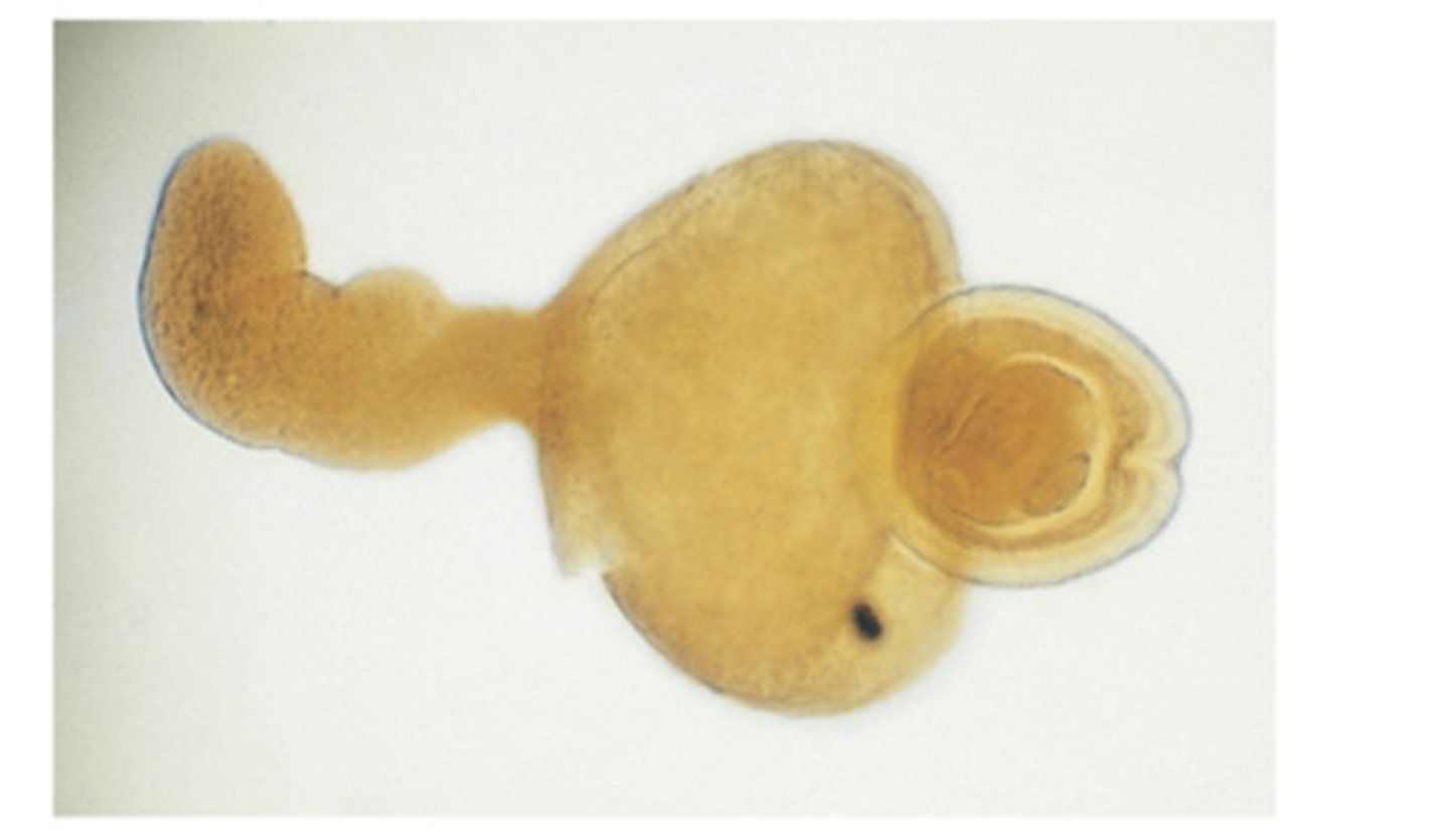 <p>Hymenolepis diminuta uses this larval stage to infect fleas, flour beetles and other arthropods to get its definitive host</p>
