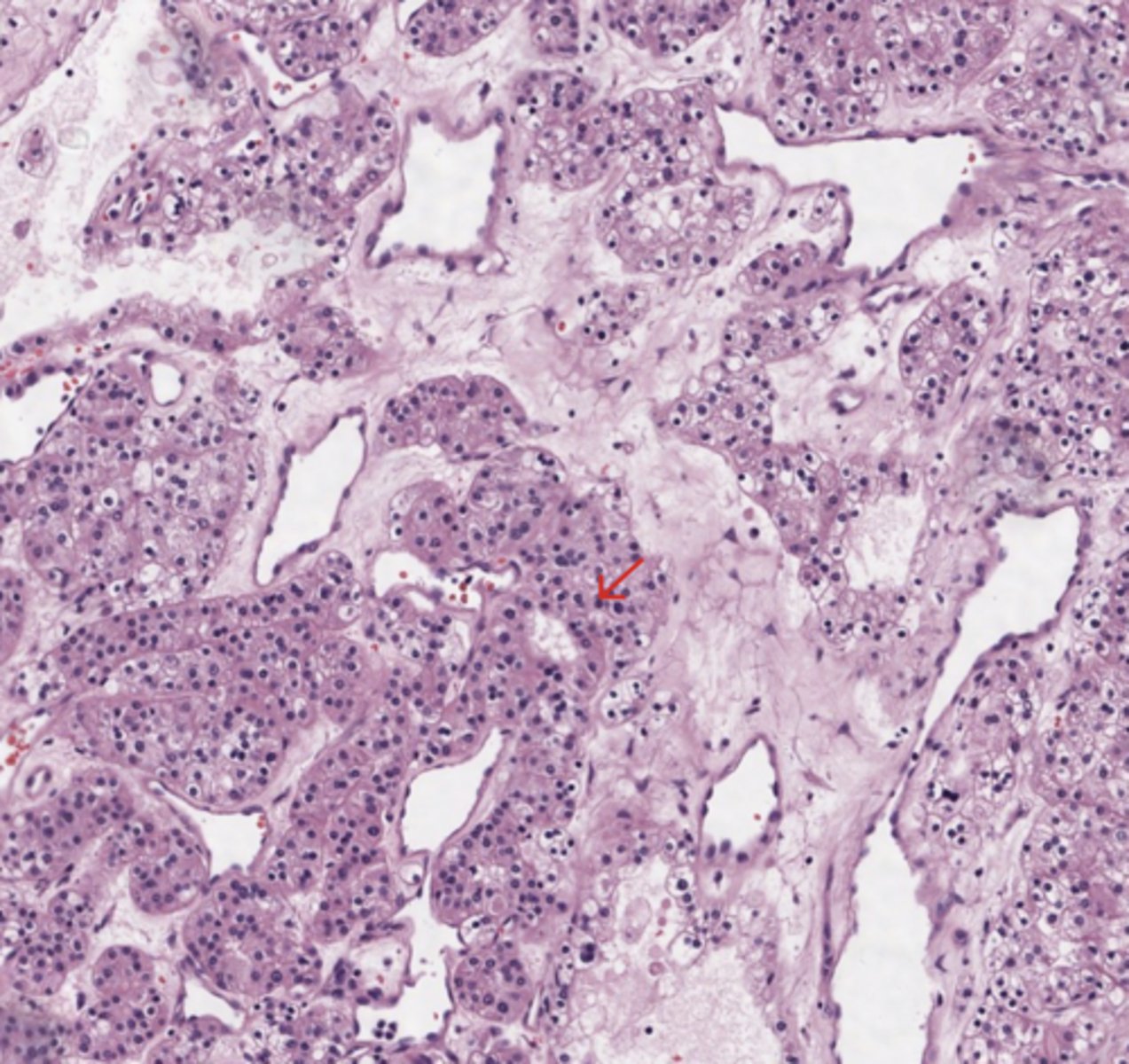 <p>Kidney</p>