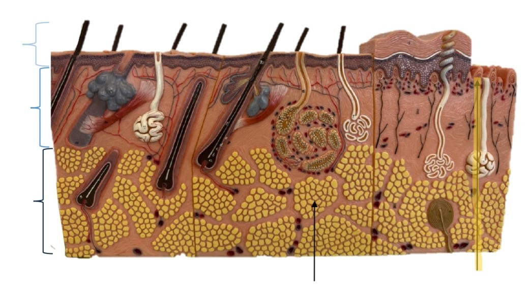 term image