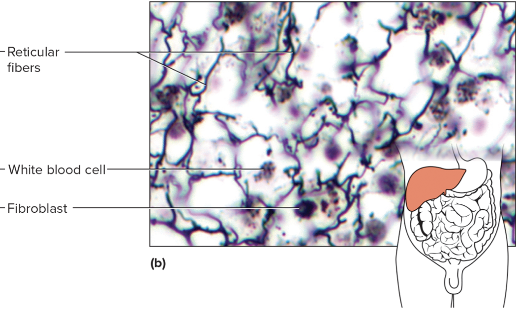 <p>name the tissue + type of connective tissue (loose/dense/specialized) </p>