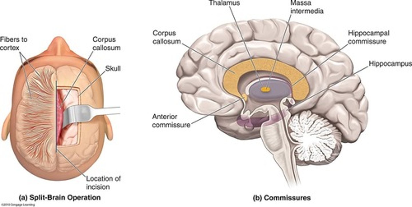 <p>A condition characterized by repeated, unprovoked seizures due to uncontrolled electrical disturbances in the brain.</p>