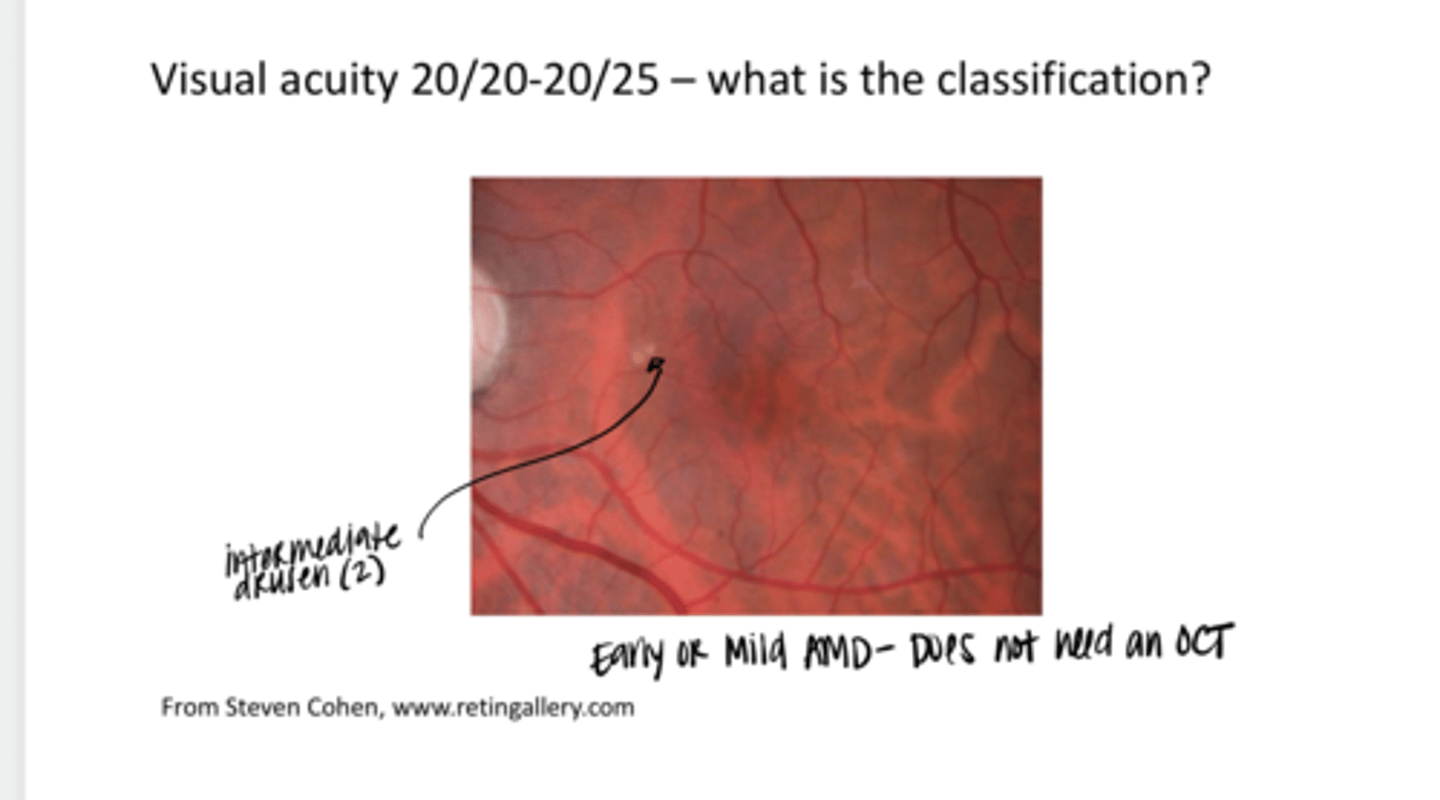 <p>Visual Acuity is 20/20-20/25. What is the classification of this AMD (see pic)?</p>