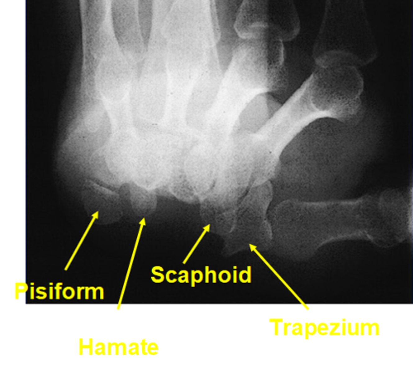 <p>1 inch on all three sides of shadow of wrist</p>