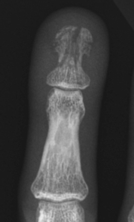 <p>What is this fracture? </p>