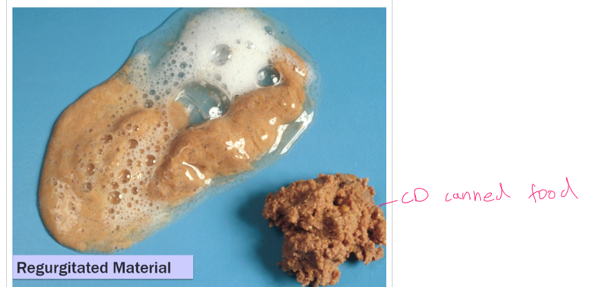 <ul><li><p>Passive expulsion of undigested food or fluid from the esophagus</p></li><li><p>a passive process that occurs without warning </p></li><li><p>only neural reflex involved is the gag reflex (to protect the airway) </p></li><li><p>classic sign of esophageal disease </p></li><li><p>Dysphagia - absent</p></li><li><p>ability to drink - normal</p></li><li><p>attempts to swallow - single</p></li><li><p>pain on swallowing - possible</p></li><li><p>abdominal contractions - absent</p></li><li><p>time after eating - <strong>usually immediate; could be delayed with megaesophagus</strong></p></li><li><p>food - <strong>undigested; tubular; foamy saliva</strong></p></li><li><p>bile (yellow) - absent</p></li><li><p>blood - <strong>bright red</strong></p></li><li><p>hair, plant, other - possible</p></li></ul><p>complications:</p><ul><li><p>aspiration pneumonia - <strong>common</strong></p></li><li><p>fluid/electrolyte imbalance - unlikely</p></li></ul><p></p>