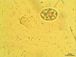 <p>This was found on a fecal floatation of a cow.</p>