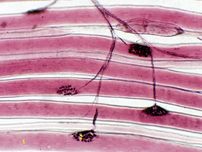 <p>What is indicated by the yellow 1?</p>