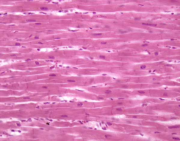 <p>Cardiac Muscle</p>