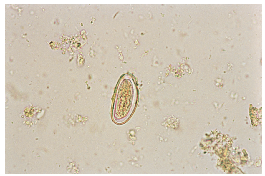 <p>The egg of the human pinworm.</p>